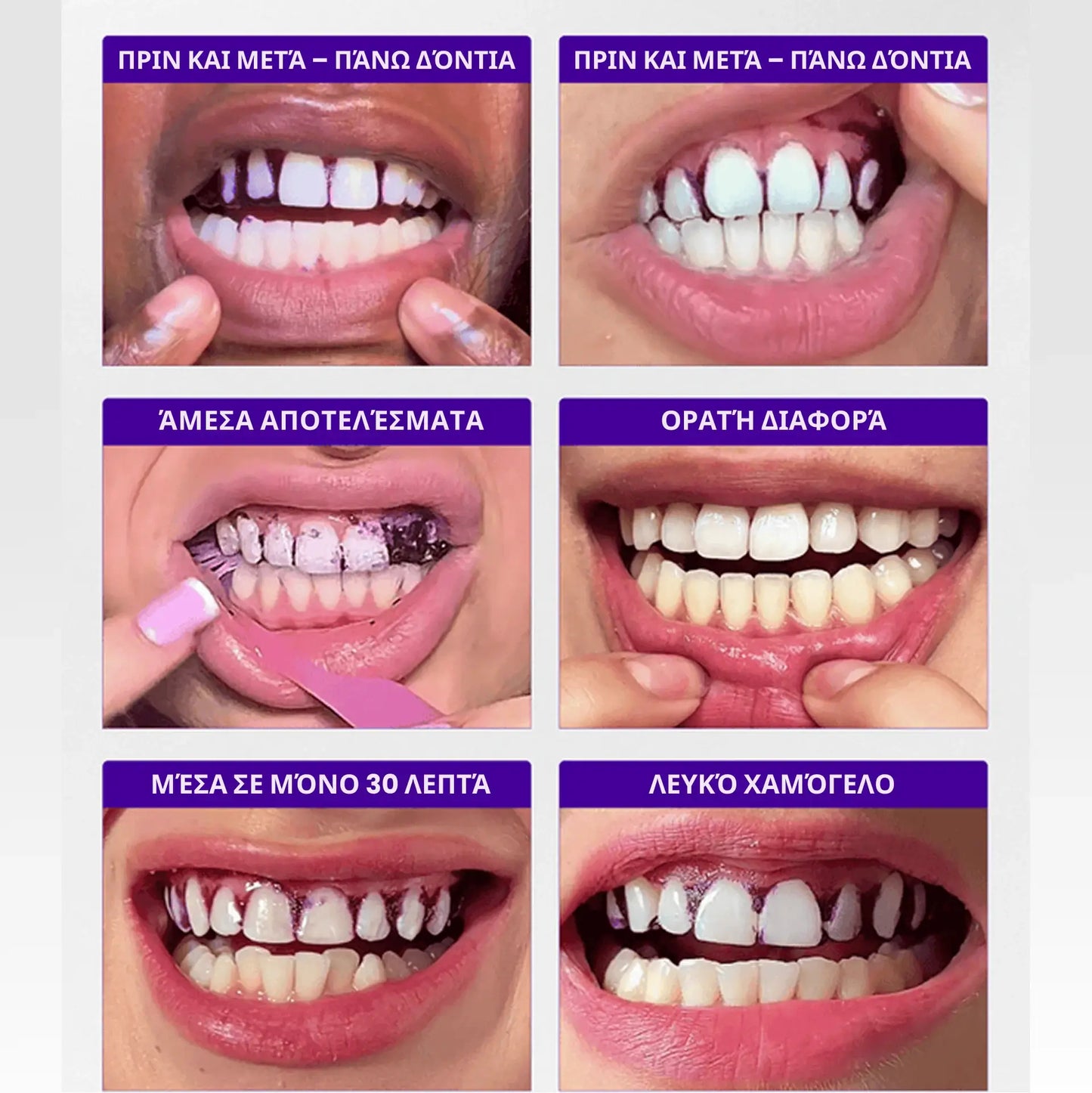 Λευκαντικές ταινίες Brytty V34