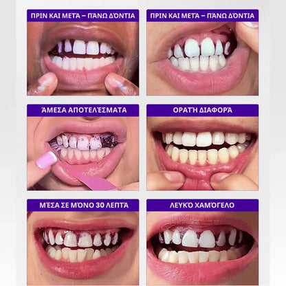 Λευκαντικές ταινίες Brytty V34