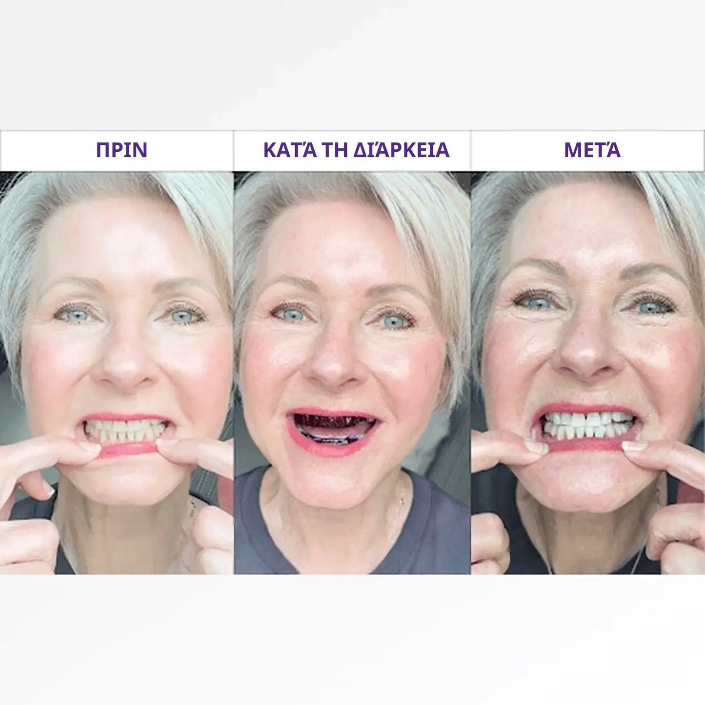 Λευκαντικές ταινίες Brytty V34