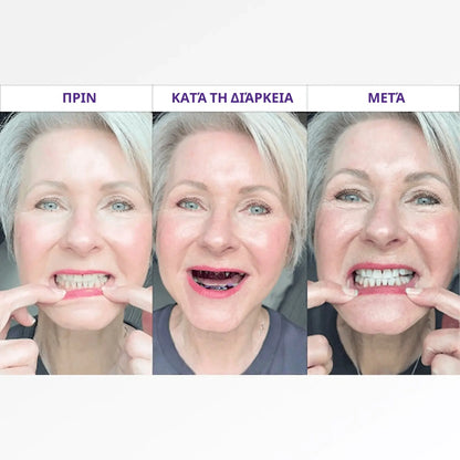 Λευκαντικές ταινίες Brytty V34