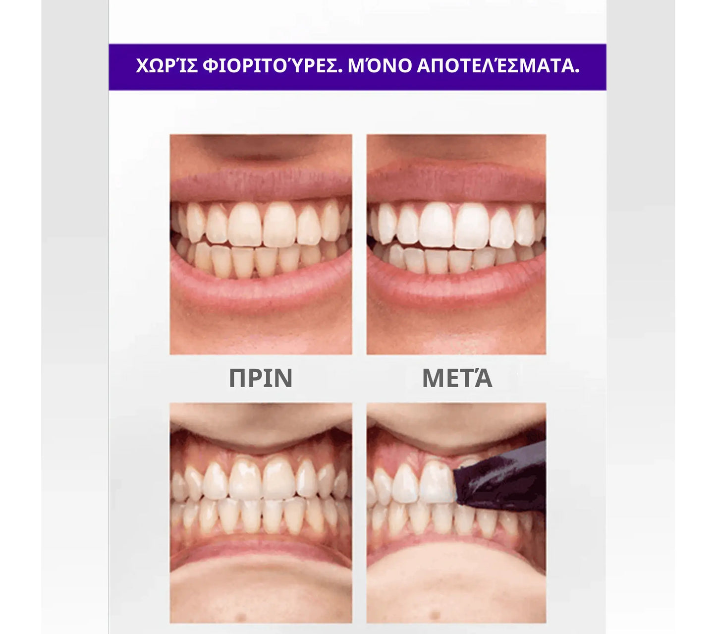 Λευκαντικές ταινίες Brytty V34