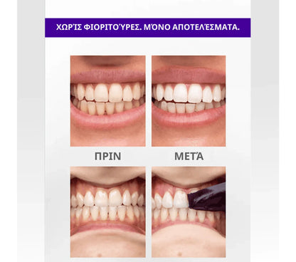 Λευκαντικές ταινίες Brytty V34